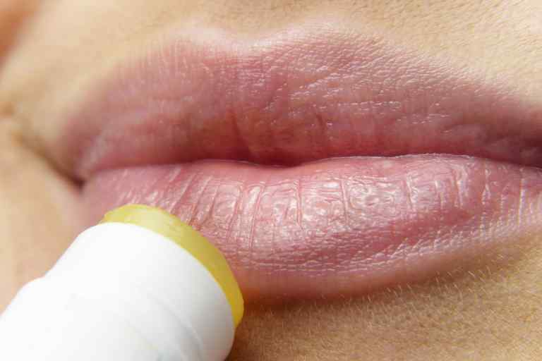 립밤 자주 바르면 5가지 증상이 (입술 건강정보)