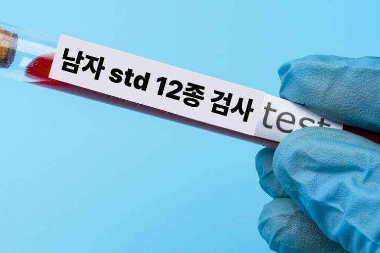남자 std 12종 검사 비용 검사종류 정확도 병원