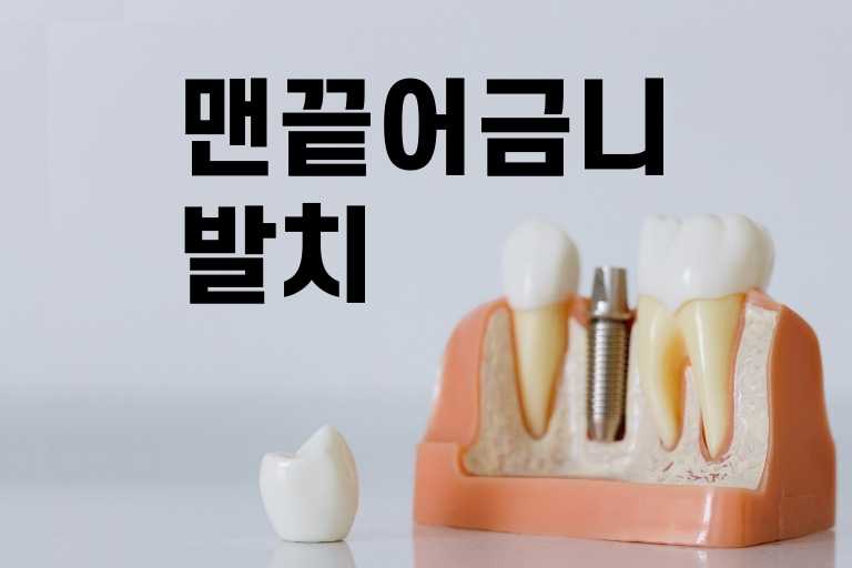 맨끝 어금니 발치
