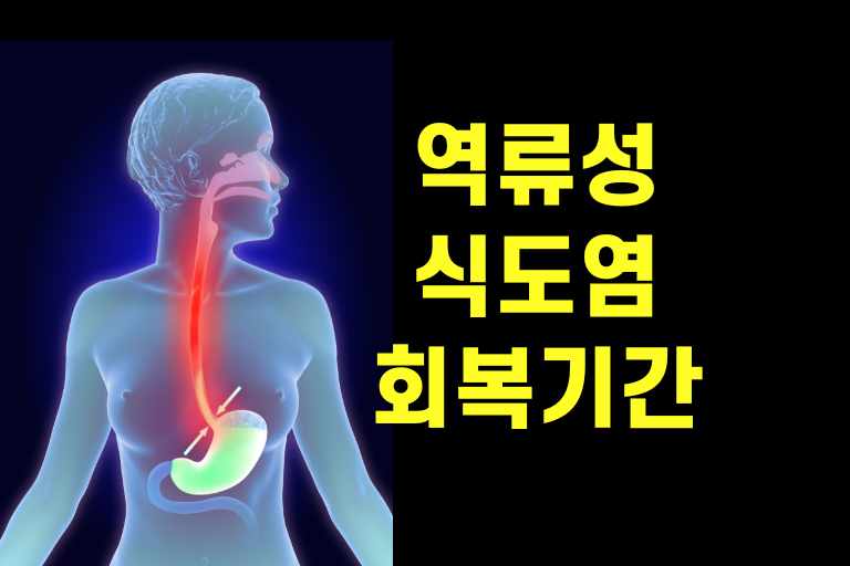 역류성 식도염 회복기간