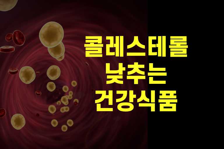 콜레스테롤 수치 낮추는 건강식품