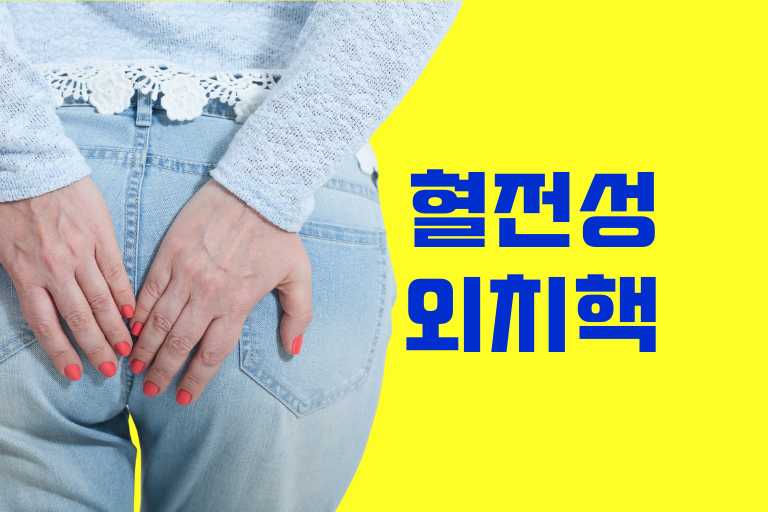 혈전 성 외치핵 터트리기